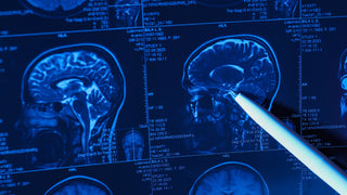 How Do Nootropics Work? Many Pathways to Whole-Brain Optimization featured image