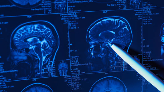 How Do Nootropics Work? Many Pathways to Whole-Brain Optimization