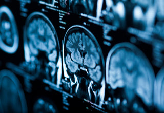 Brain scan to show healthy brain imaging. 
